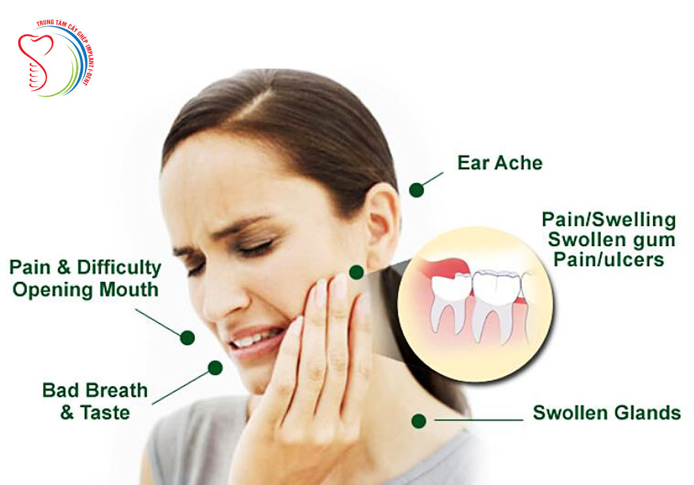 Wisdom Teeth Extraction Ontario Cost