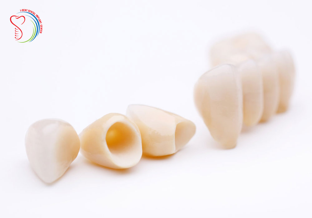 Advantages and disadvantages of Titanium dental teeth