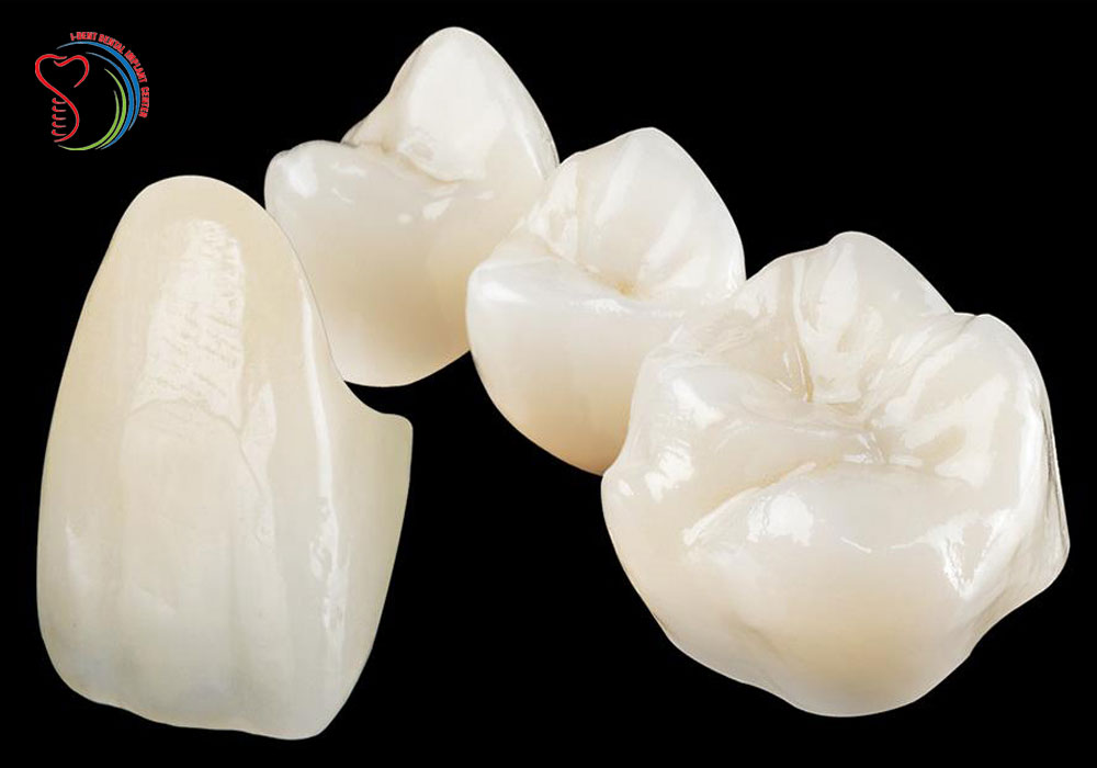 Vietnam implant dentistry 