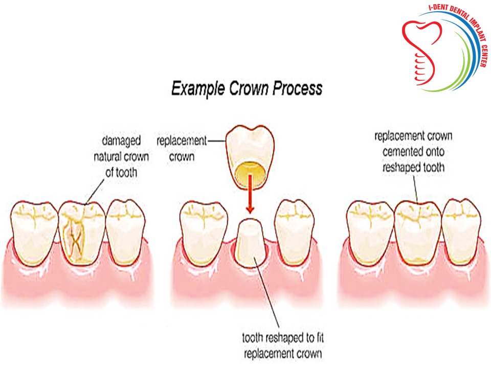 7 Life-Saving Tips About dentistry in Dwarka