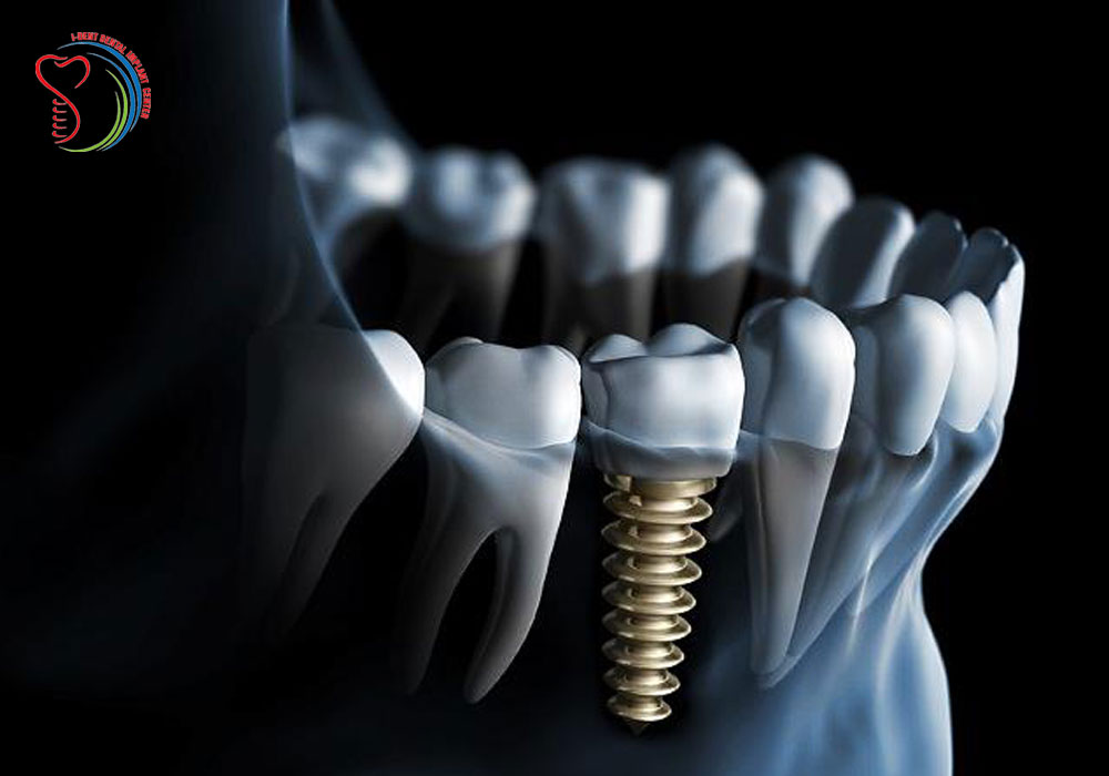 Dental tourim in Vietnam