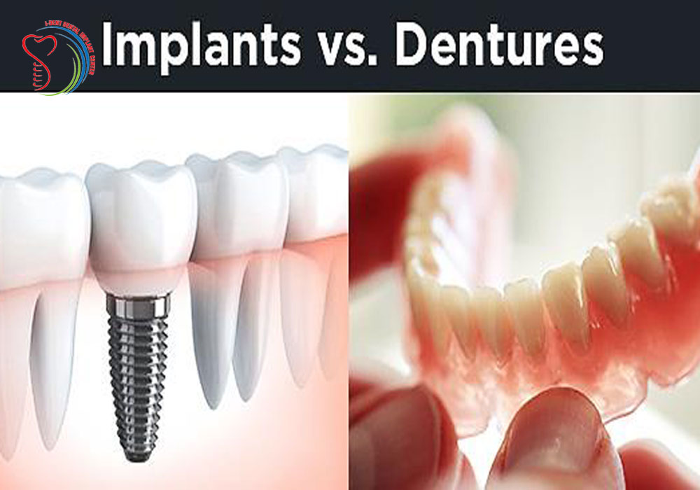 Growing Permanent Teeth, Which Method is the Best