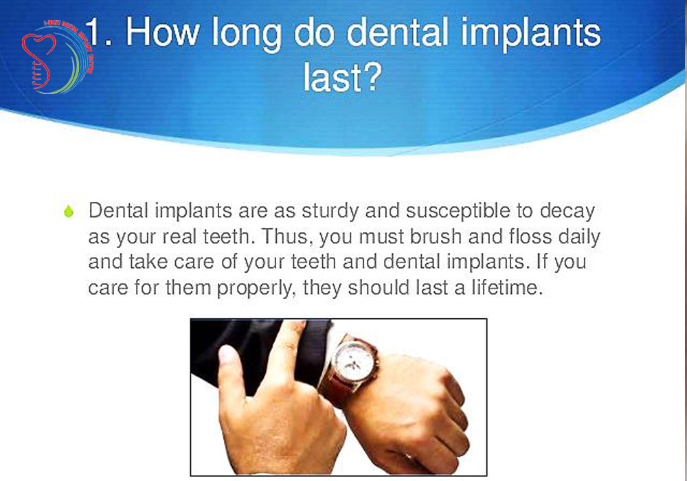 how-long-do-dental-implants-last