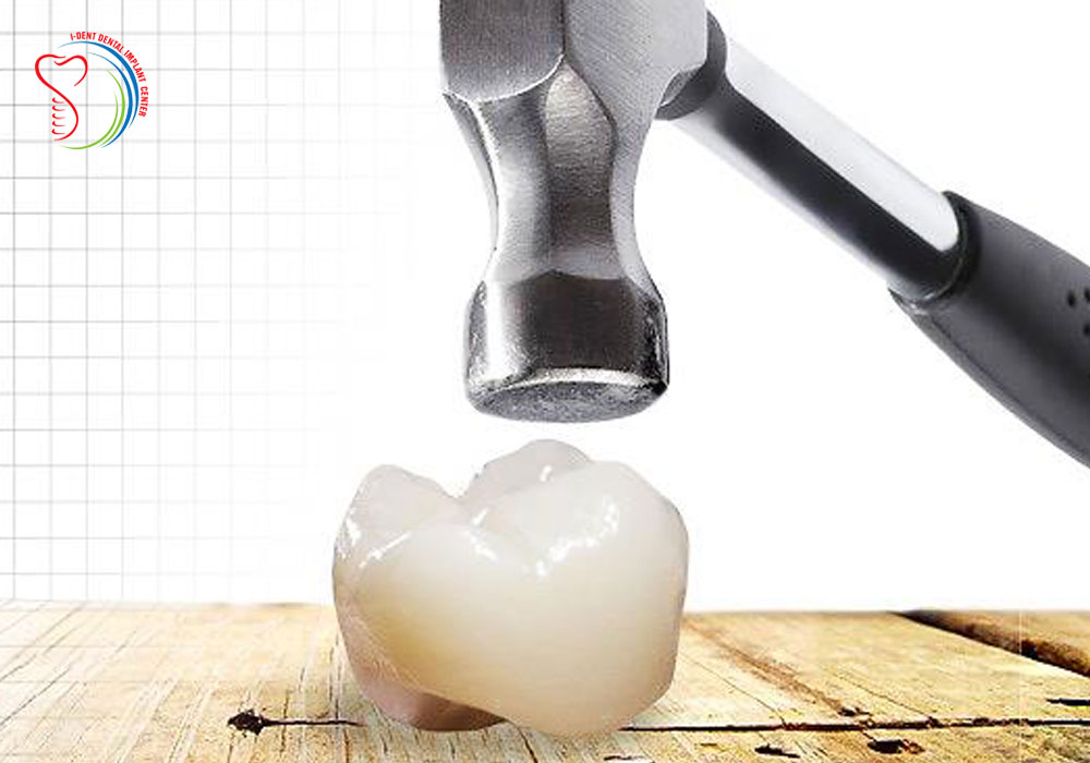 Denal crown done by internation dentist in Vietnam