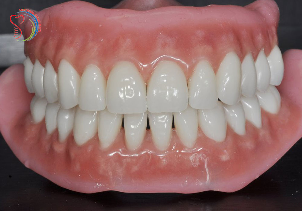 Make full dentures