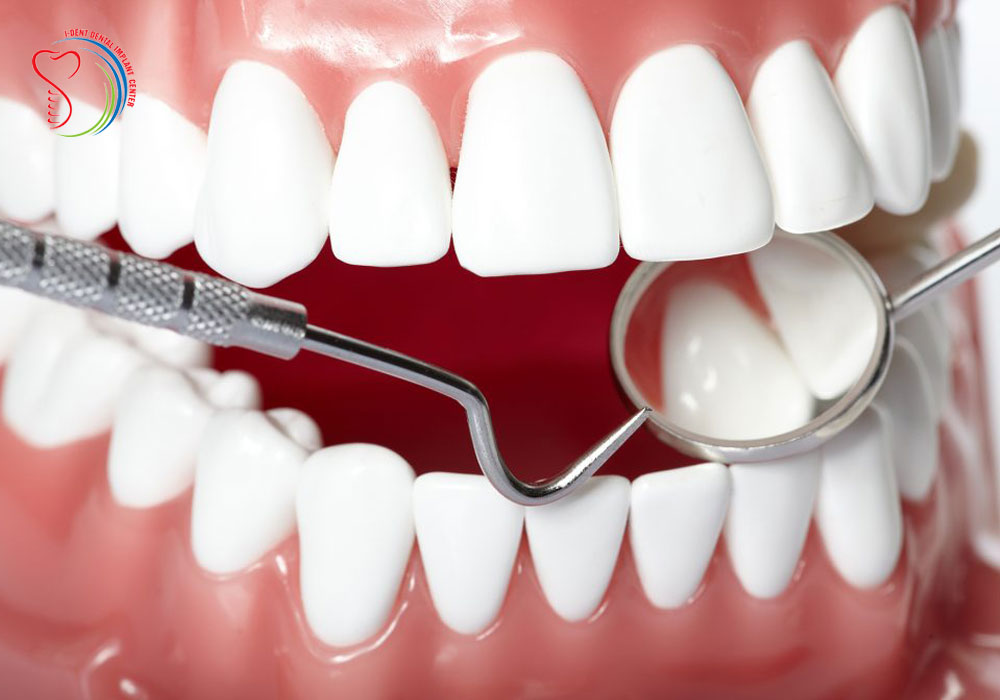 The cost of an implant tooth in Vietnam