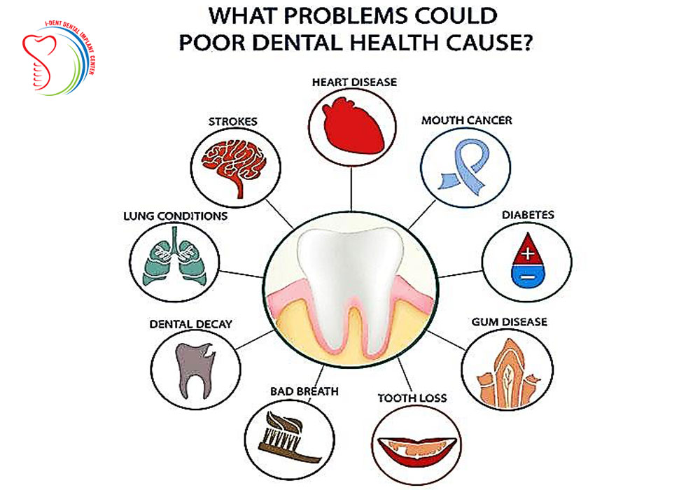Dental crowns Ho Chi Minh City Dental crowns Ho Chi Minh City