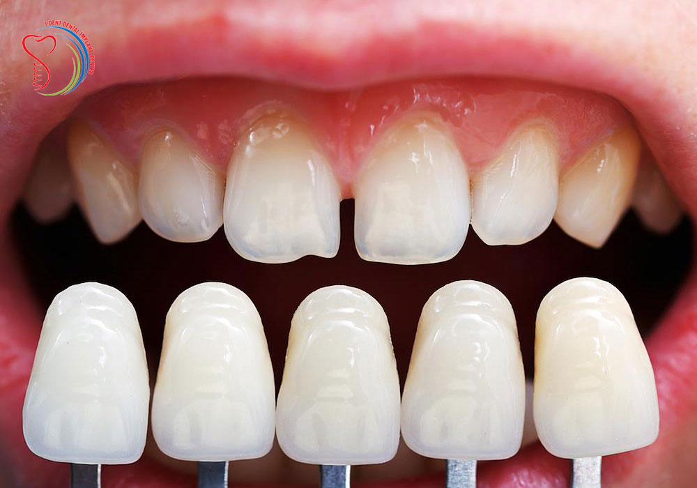 Dental tourim in Vietnam