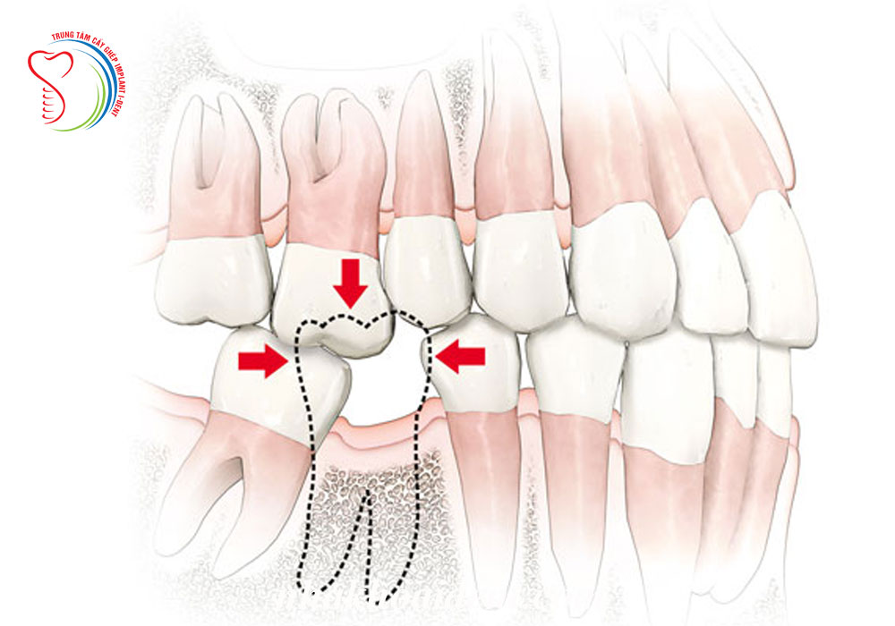 Saigon dental clinic 