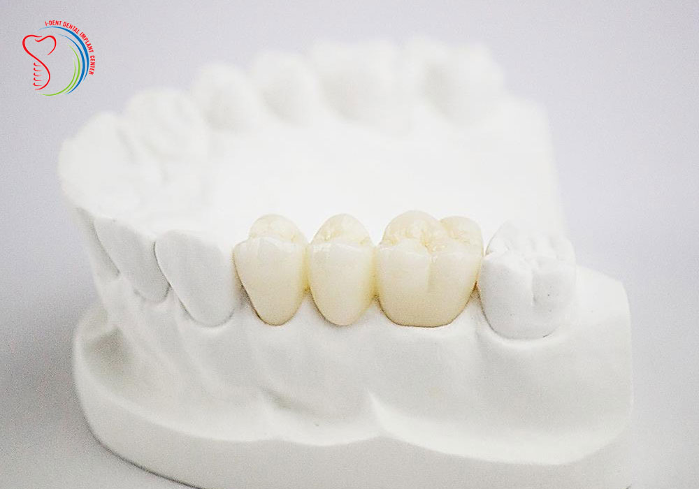 Saigon Vietnam dental implants 